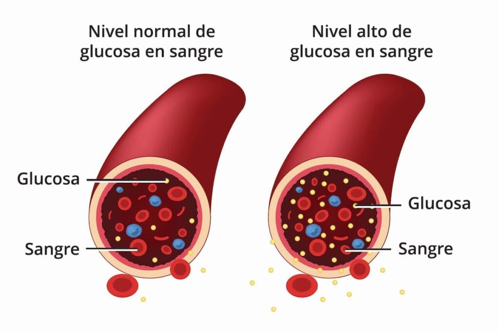 Te ayudamos a controlar la diabetes en Granada con Nutri Cognicion
